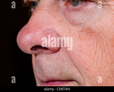 Vue de côté de l'homme mûr nez et la lèvre supérieure avec les yeux à peine visible Banque D'Images