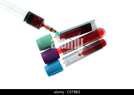 Prélèvement des échantillons de sang Banque D'Images