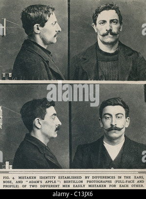 Système Bertillon photographies prises de même à leurs différentes identités hommes établi par des différences dans leurs oreilles, nez, et Adam's apples. Banque D'Images