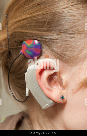 Lisa est le port d'un implant cochléaire implant auditif ( ) Banque D'Images