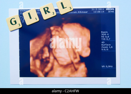 L Echographie Bebe Garcon Scabble Ecrit Des Lettres Photo Stock Alamy