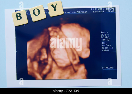 L'échographie de bébé, c'est un garçon. Banque D'Images