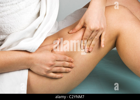 Woman la cellulite sur les jambes assis sur table de massage Banque D'Images