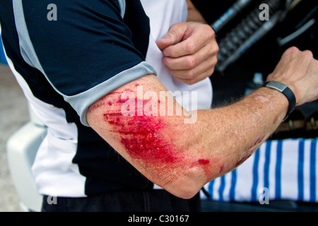 Un coureur de vélo de montagne tend à ses blessures après un accident. Banque D'Images