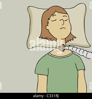 Une image d'une femme sur un tube respiratoire. Banque D'Images