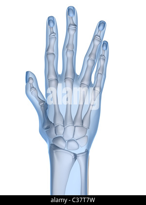 X-ray mains - arthrite Banque D'Images