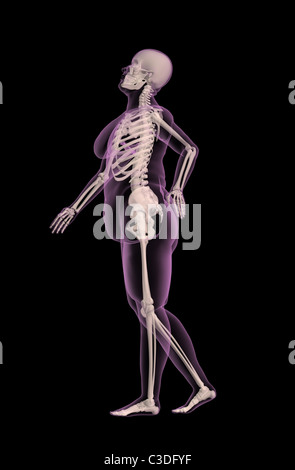 3D render of an overweight female medical skeleton avec douleur au dos Banque D'Images