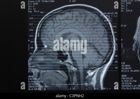 X-ray image head, Close up Banque D'Images