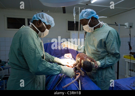 C-section,chirurgie,hôpital,Betou MSF en République du Congo Banque D'Images
