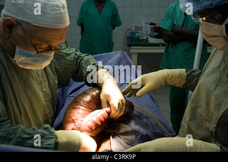 Chambre d'exploitation,chirurgie,hôpital,Betou MSF en République du Congo Banque D'Images