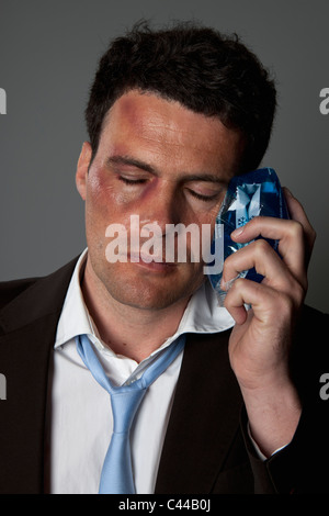 Un battu businessman holding une poche de glace sur sa joue Banque D'Images