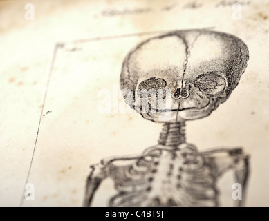 Squelette du foetus vers 1844 avec selective focus Banque D'Images