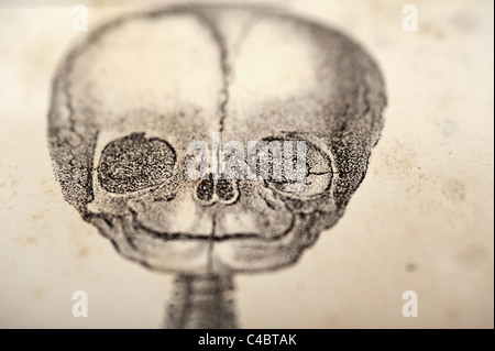 Illustration de foetus crâne circa 1844 - macro, très faible profondeur de champ Banque D'Images