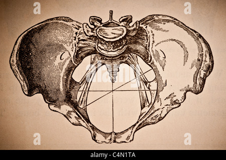 Illustration médicale antique d'un os du bassin Banque D'Images