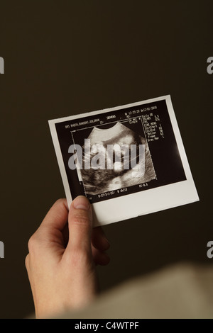 Woman holding echographe photo de bébé Banque D'Images