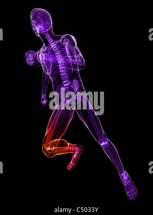 Jogger avec les articulations des genoux douloureux Banque D'Images