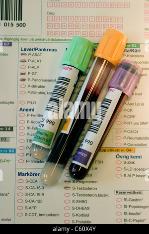 Des échantillons de sang dans des tubes à essai en face de l'ordre de test (en suédois) Banque D'Images