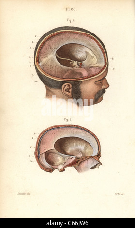 Les coupes transversales à travers le crâne. Banque D'Images
