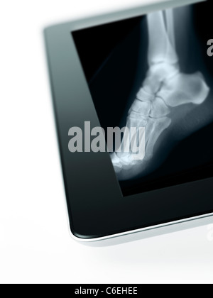 Studio shot of digital tablet with x-ray de pied humain Banque D'Images