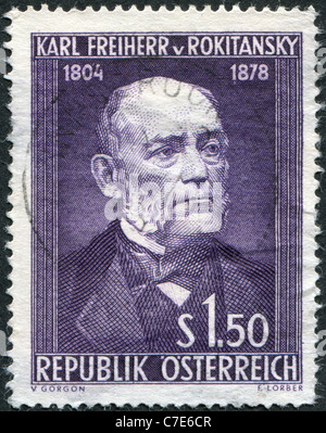 Autriche - 1954 : timbre imprimé en Autriche, est dédié au 150e anniversaire du baron Carl von Rokitansky Banque D'Images