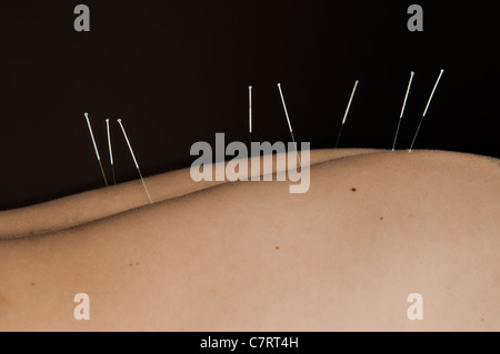 Dans l'Acupuncture points arrière sur mans retour Banque D'Images