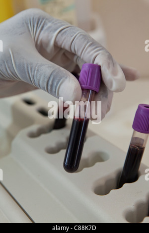 Un des techniciens de laboratoire des échantillons de sang d'essai des patients atteints du VIH dans un hôpital de Luanshya, Zambie. Banque D'Images