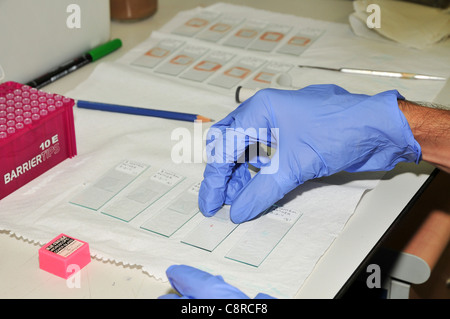 La préparation des diapositives de l'échantillon pour voir sous un microscope optique. Photographié à l'Université de Haïfa Banque D'Images