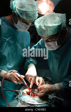 Médecins pratiquant la chirurgie la prostatectomie en salle d'opération Banque D'Images