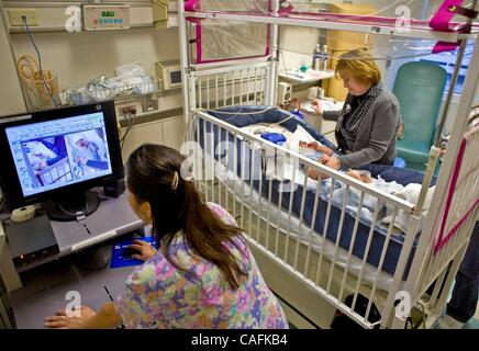 27 févr. 2008 - Los Angeles, Californie, USA - un bébé garçon dans un hôpital de Californie souffrant de moelle bifida porte une électrode-remplie d'électroencéphalographie (EEG) de l'électrode "PAC" et d'épais massifs de câbles à l'ordinateur suivi de l'état de l'enfant qui comprend un système de télévision en circuit fermé Banque D'Images