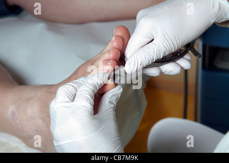 Un podiatre couper les ongles des pieds d'une femme Banque D'Images