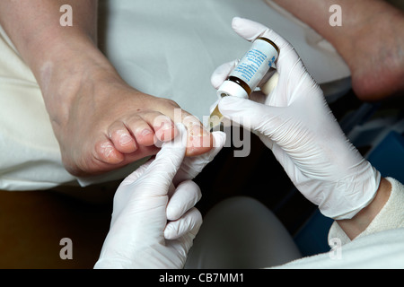 Un podiatre édité pour les pieds avec huile manucure Banque D'Images