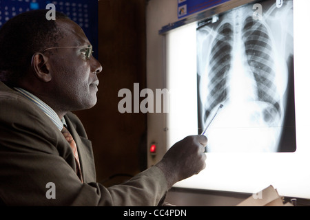 Un médecin à Kampala, Ouganda examine un patient's chest x-ray. Banque D'Images