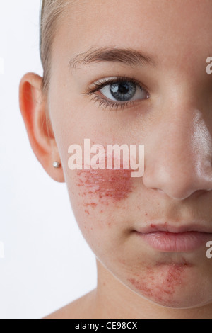 Portrait of Girl (12-13) avec des rayures et des cicatrices sur le visage Banque D'Images