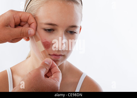 Mains d'appliquer l'adhésif bandage sur girl's (12-13) face à Banque D'Images