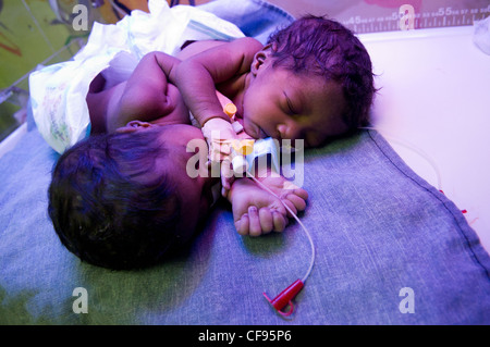 Lits jumeaux siamois filles sont nées à 19 ans, Agnès Anyait Ojangole et Augustin, 23, samedi 22 octobre 2011. Kampala, Ouganda. Banque D'Images