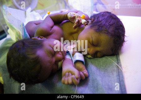 Lits jumeaux siamois filles sont nées à 19 ans, Agnès Anyait Ojangole et Augustin, 23, samedi 22 octobre 2011. Kampala, Ouganda. Banque D'Images