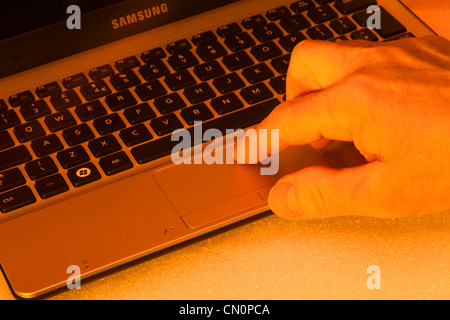 Un homme l'aide d'un netbook avec un cast orange Banque D'Images