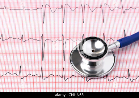 Photo d'un électrocardiogramme ou ECG EKG impression with stethoscope Banque D'Images