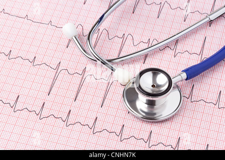 Photo d'un électrocardiogramme ou ECG EKG impression with stethoscope Banque D'Images