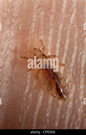 Poux de tête (Pediculus capitis, ou Pediculus humanus capitis, ou Pediculus humanus), louise sur la peau humaine, Allemagne Banque D'Images