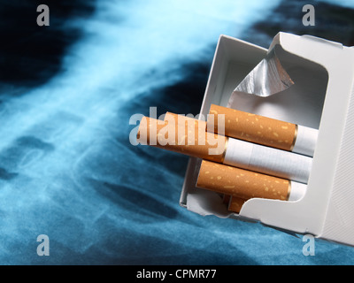 Les paquets de cigarettes avec x-ray image pulmonaire dans l'arrière-plan. Banque D'Images