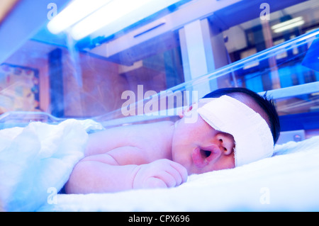 Bébé nouveau-né sous lampe à ultraviolet dans l'incubateur Banque D'Images