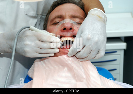 Un dentiste de retirer la plaque et le tartre des dents d'un homme de prévenir les caries et autres problèmes d'peridontal Banque D'Images