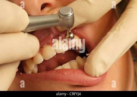 Une jeune fille a ses dents nettoyées et polies par un dentiste à l'aide d'une brosse à dents électrique. Banque D'Images