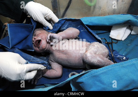 New Born Baby en berceau, peu après la naissance (cordon ombilical encore attaché). Banque D'Images