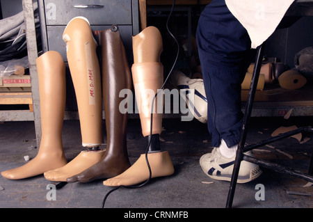 Une sélection d'une prothèse du bas des jambes n'est pas terminée dans un atelier de prothèses. Banque D'Images