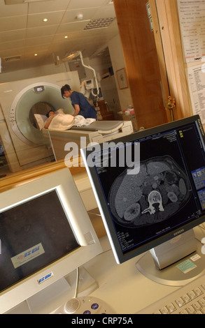 Un patient ayant un scanner CT avec l'image présentée sur un écran d'ordinateur Banque D'Images