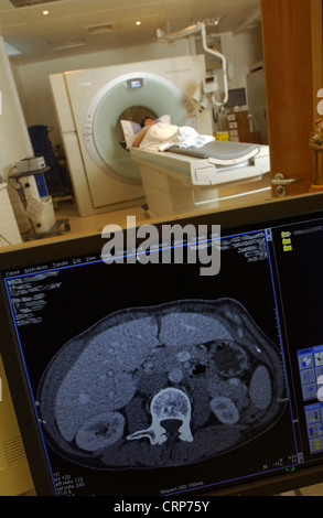Un patient ayant un scanner CT avec l'image présentée sur un écran d'ordinateur Banque D'Images