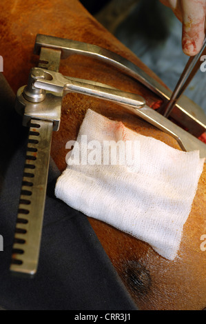 Les chirurgiens utilisent un rétracteur pour obtenir un accès sans restriction dans la poitrine du patient. Banque D'Images