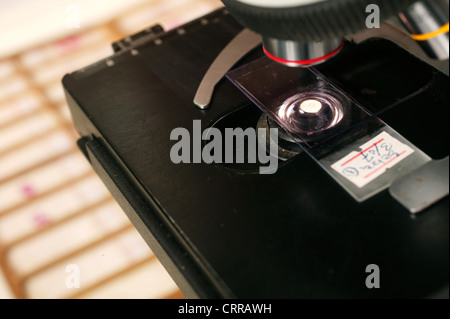 Faites glisser la cytologie sur la scène d'un microscope. Banque D'Images